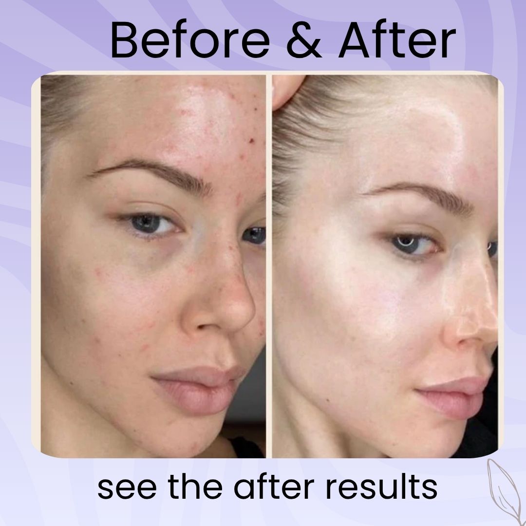 PopGlow™- Rice Collagen Mask