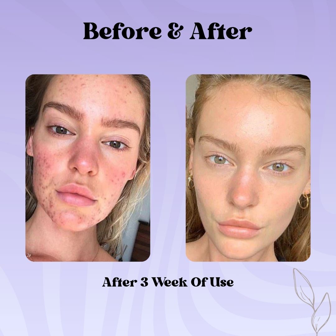 Deep Collagen Retinol Tension Boost-Up Mask