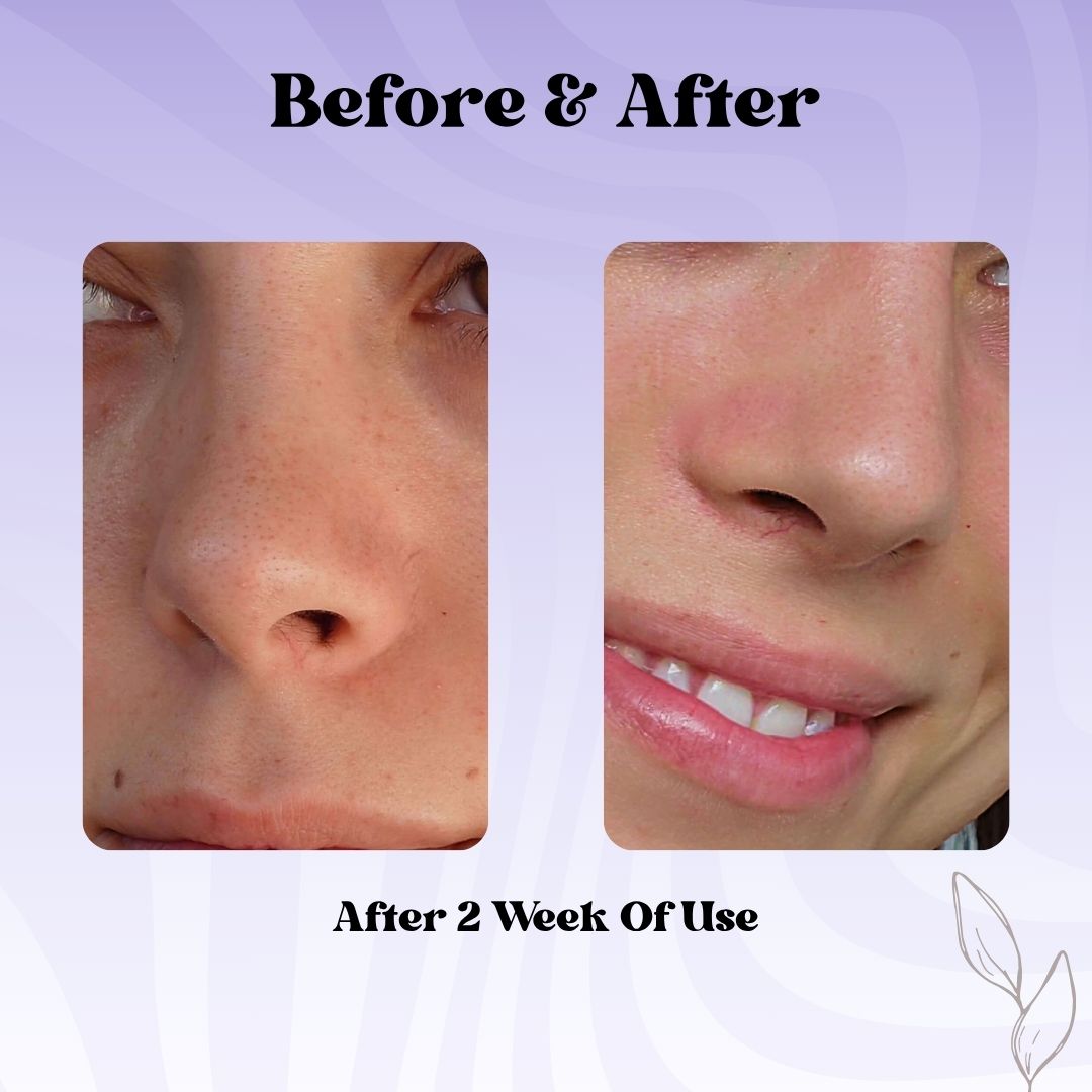 PopGlow™ - Clear Pore Patch